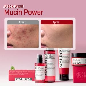 SNAIL TRUECICA MIRACLE REPAIR CREAM 60g